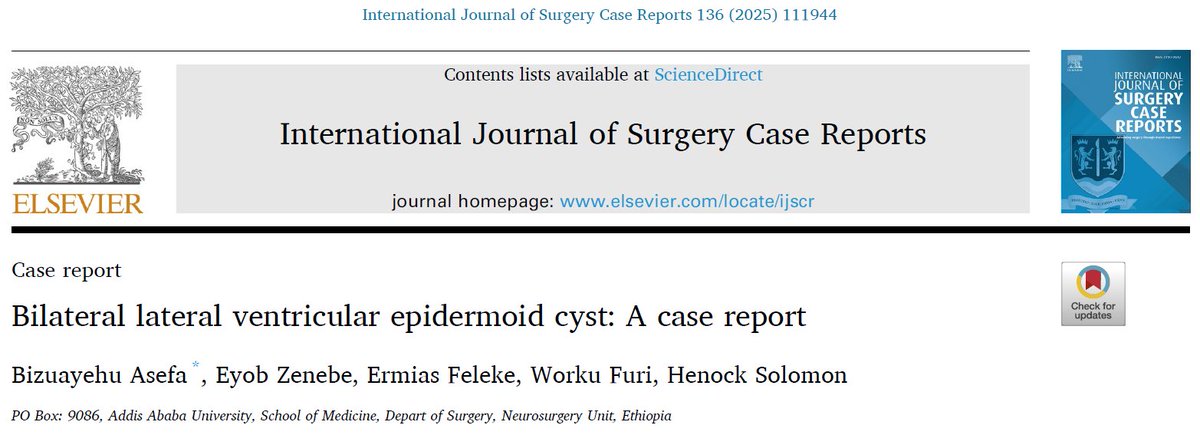 ✅ Bilateral lateral ventricular epidermoid cyst

These lesions usually show the combination of marked diffusion restriction with incomplete FLAIR suppression, even if CT shows near fat attenuation, a finding that can appear in cholesterol-rich epidermoids
doi.org/10.1016/j.ijsc…