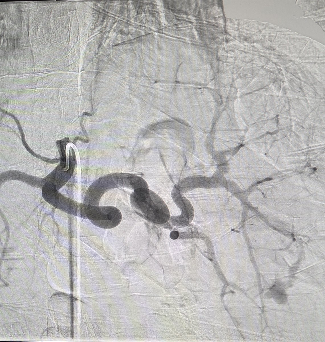 Temple Radiology tweet media