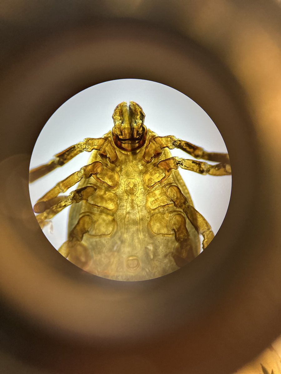 Alpha gal is an unrecognized health crisis in the U.S. It is an allergy primarily spread through the saliva of the lone star tick. Their habitat was limited to the southern states until a late 1960s Army-funded study released 100K+ radioactive lone star ticks so they could track