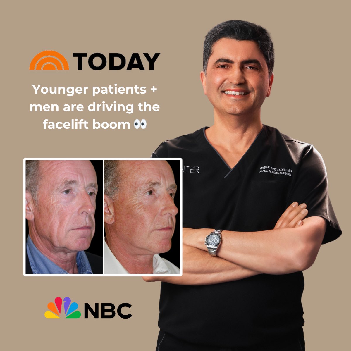 Younger patients. More men. The facelift landscape is changing — and we’re seeing the shift in real time.

I recently spoke with <a href="/TODAYshow/">TODAY</a> about the cosmetic surgery boom and why we’re seeing a major rise in male facelift patients and younger individuals seeking earlier, more