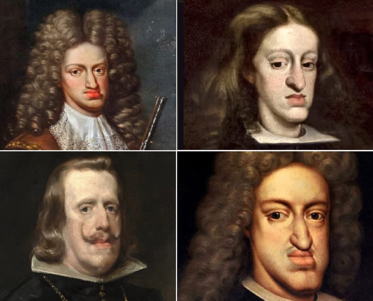 Why do all the superior race types look like they’re inbred? It’s called a Habsburg jaw.
