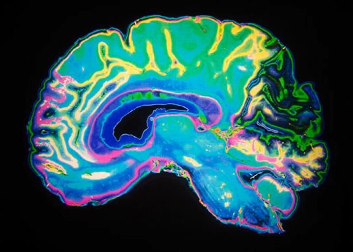 When you cut out cheap dopamine, your mind stops chasing tiny thrills. That shift matters in trading.

Quick hits from social media or constant entertainment train you to expect instant rewards. Trading demands the opposite. Most of the time you wait. If you’re wired for fast