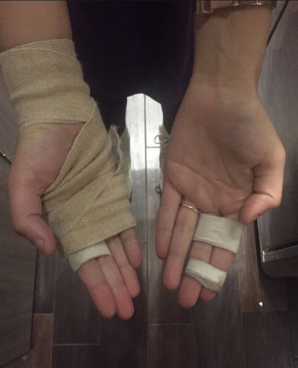 On this day 10 years ago, November 14th 2015, Halsey shares a picture of her injured hands. 

“Def made my hands worse tonight. My Collection of broken knuckles is increasing im using the talk to text function”