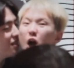 곤란하다
눈보다 애굣살이 더 크다..