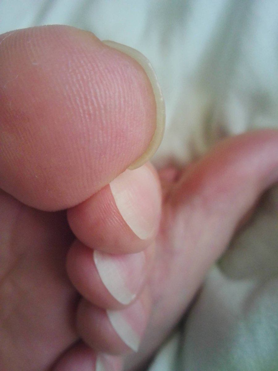 ゆうま🦁 (@yumapet) / Posts / X