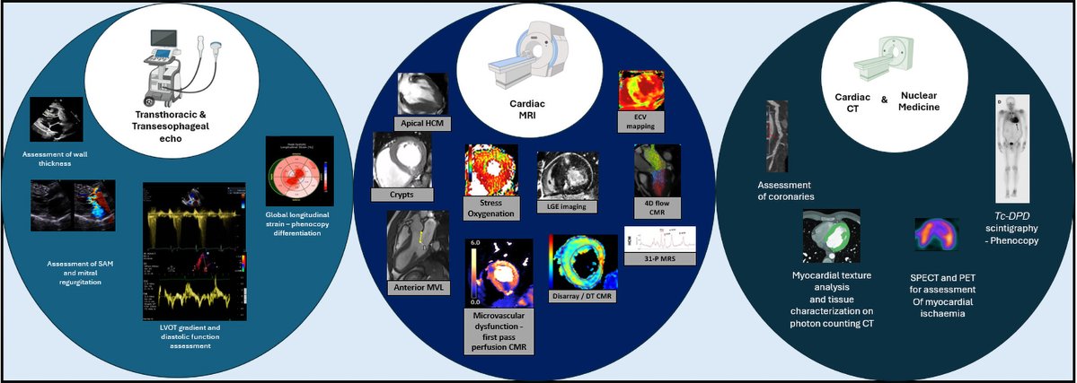 salvasapedraza's tweet image. A Review of Multimodality Imaging in Hypertrophic Cardiomyopathy: Diagnosis, Risk Stratification, and Therapeutic Guidance

Authors: Rahul Gandhi, MBCh. pubs.rsna.org/doi/10.1148/ry…