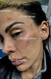 isaferya's tweet photo. Cada vez que alguien del team Eleazar te quiera ofender, ponle está imagen y recuérdale que si por él fuera, a ese fan lo dejaría así (Y más si es mujer o gay)

 #LaGranjaVIP https://t.co/MT6AYbtTlE