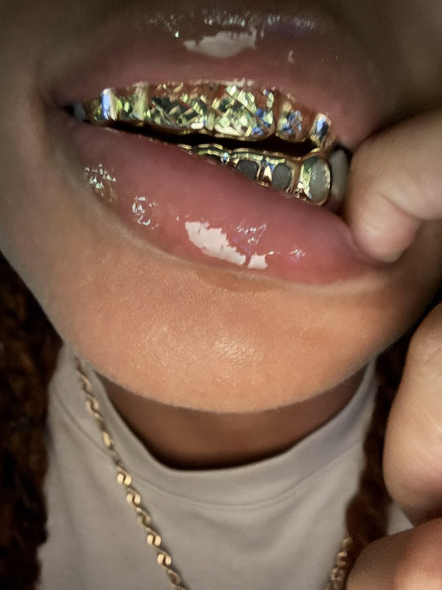 _kaylo20's tweet photo. Big lips+ a grill combo 🥴>> https://t.co/dmmjnBdxQJ