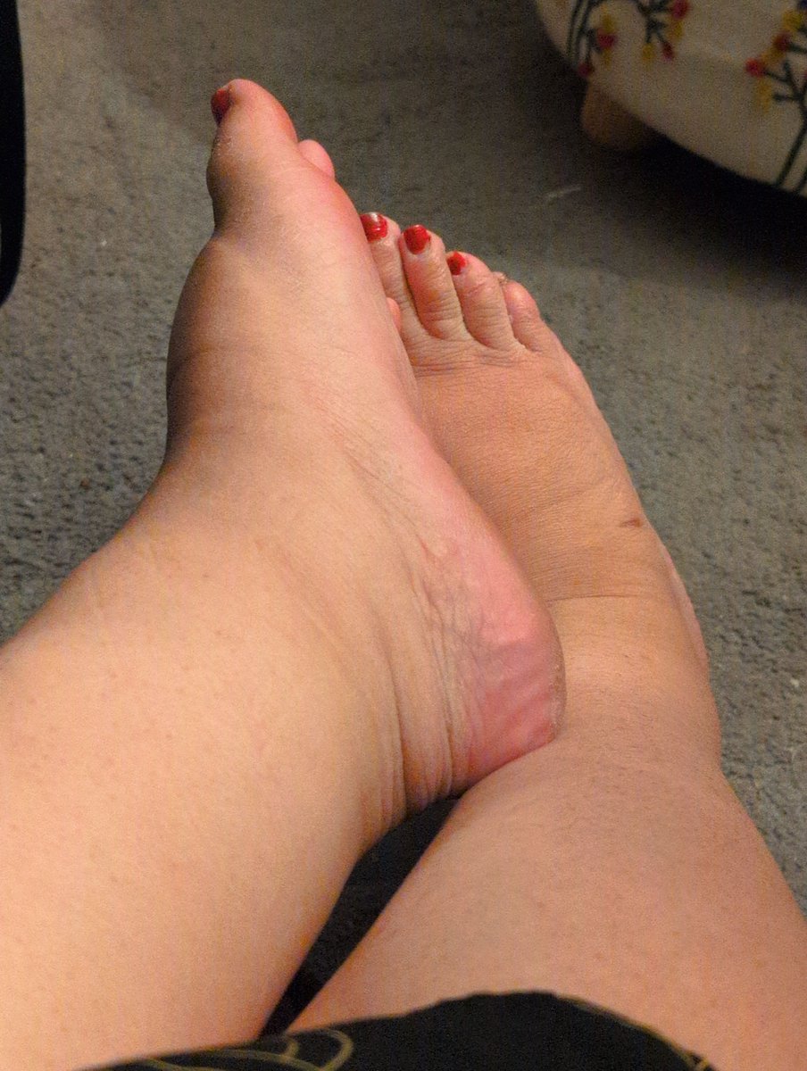 The days are becoming cold, as are my toes. Warm them. 
#feet 

Be clever and look at the links