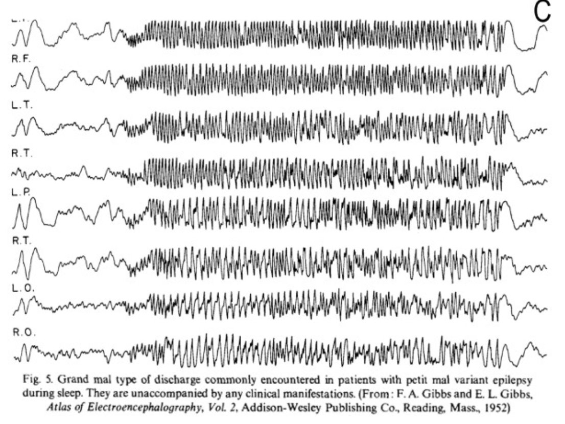 Philippe Gelisse tweet media