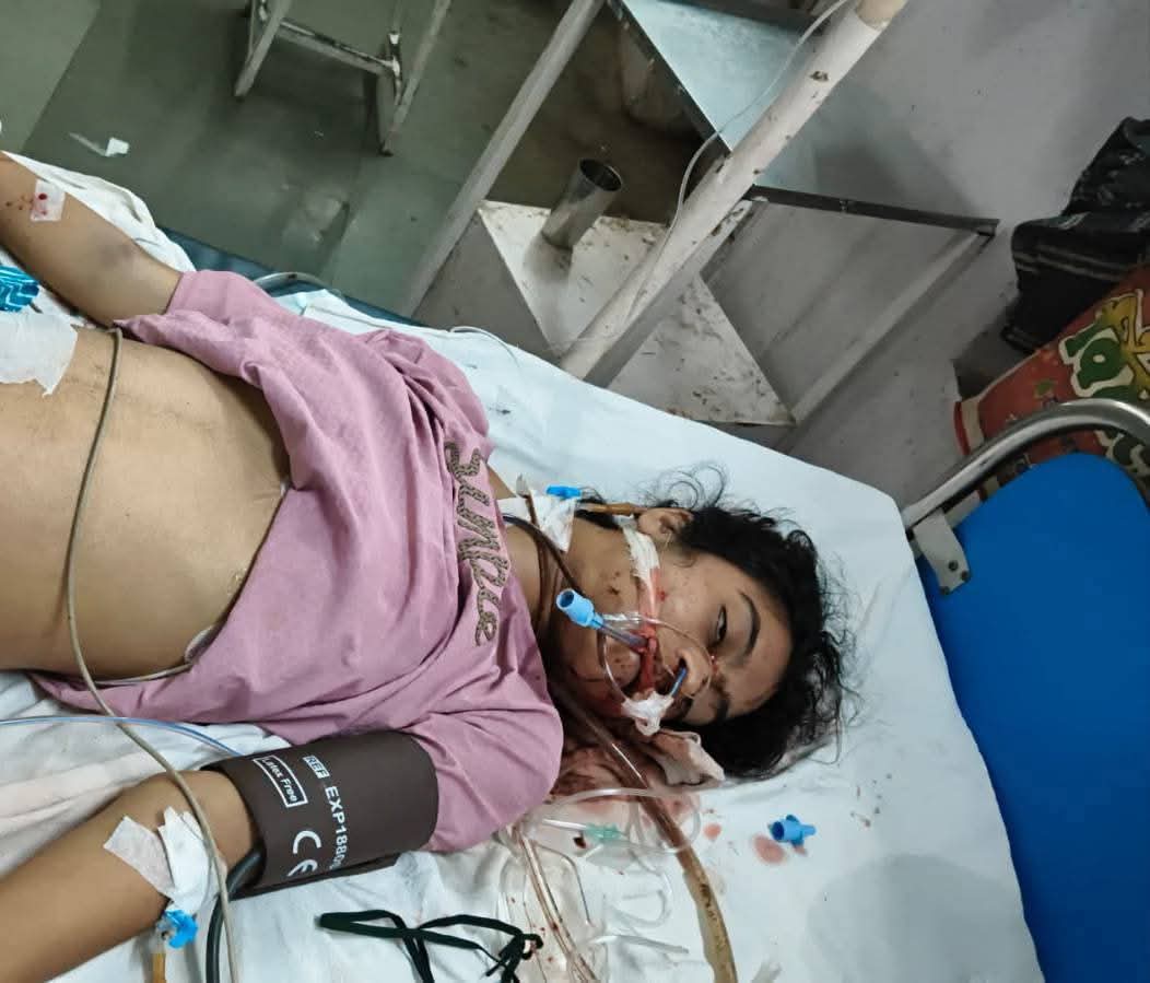 Sonu_Aazad's tweet image. बांसवाड़ा जिले के महात्मा गांधी हॉस्पिटल के डॉक्टर हितेन व्यास की लापरवाही ने एक मासूम की जान ले ली।

परिवार न्याय के लिए धर धर भटक रहा है @Dmbanswara दोषी डॉक्टर पर तत्काल हत्या का मुकदमा दर्ज कर गिरफ्तार करें।

ऐसे अपराधी खुले कैसे घूमते हैं!
क्या इनको सरकार की शह मिलती है?