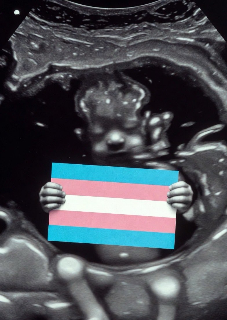 damekatydenise_'s tweet image. Some foetuses are Trans, deal with it &amp;amp; get over it. 

#TransAwarenessWeek 🏳️‍⚧️