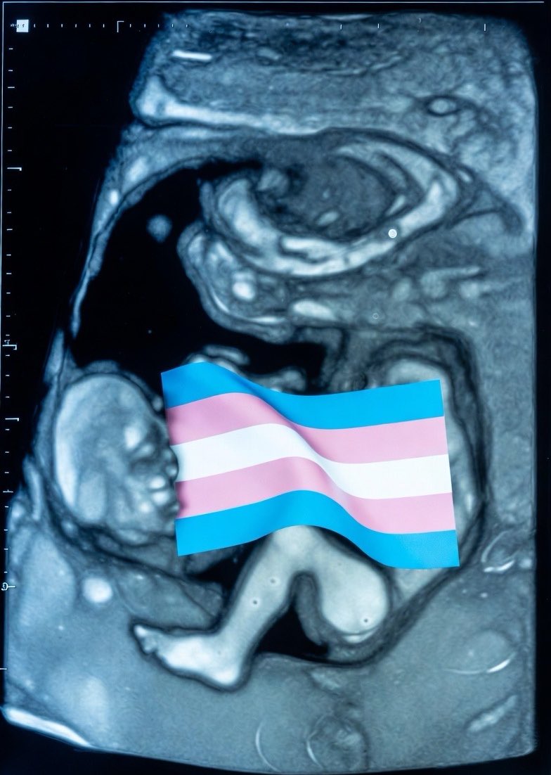 damekatydenise_'s tweet image. Some foetuses are Trans, deal with it &amp;amp; get over it. 

#TransAwarenessWeek 🏳️‍⚧️