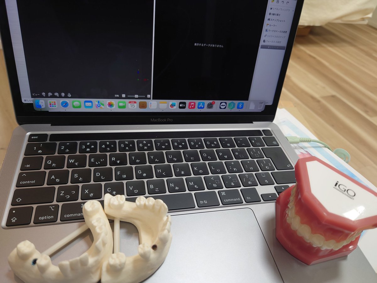 インプラントの設計用に MacBook Pro買いました。