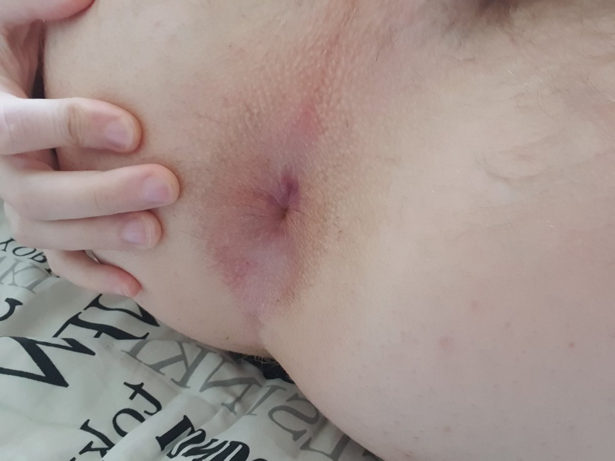 Wanna get Asian owned so badly. Please use my white fag pink bussy. 🙇‍♂️ #AMWM #AMWF #gayasian