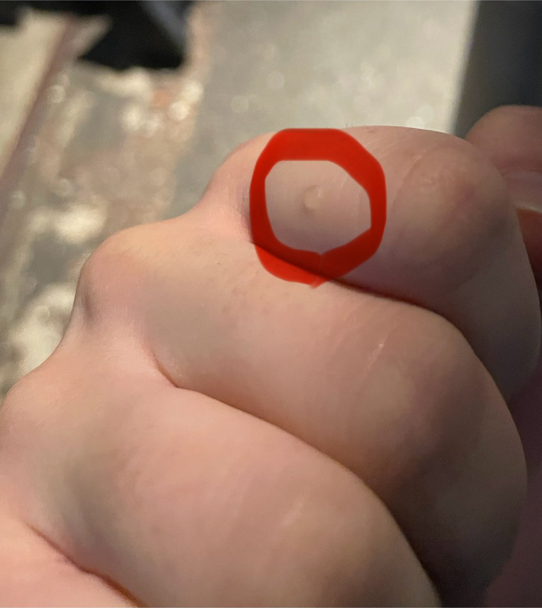 #i_Risぴあアリーナ対よろ
ペンラ振りすぎて豆できてた､､､