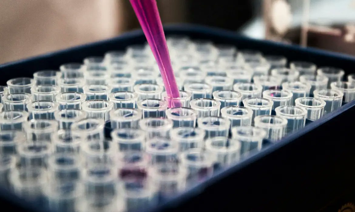 CBRTV1's tweet photo. Estudo mostra que inflamação no cérebro pode ser chave do Alzheimer
Pesquisa foi liderada por laboratório do neurocientista Eduardo Zimmer  

Giro de Noticias - CBRTV
Flávia Albuquerque
Foto-Louis Reed/ Unsplash
Edição-Fernando Fraga
Fonte-Agência Brasil https://t.co/oXW3DAmbKN
