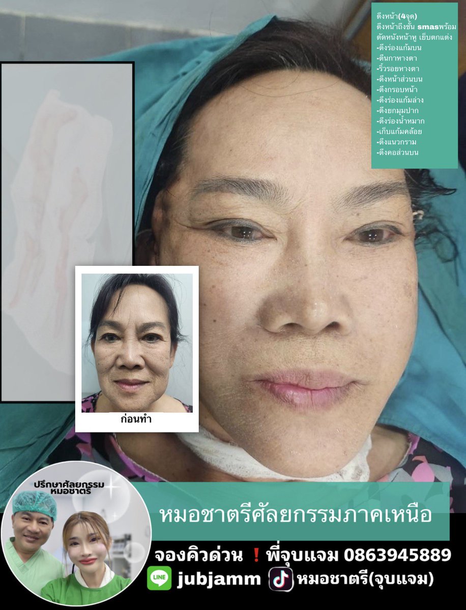 O2MUgkaZ1sfpmWa's tweet photo. #ดึงหน้าหมอชาตรี https://t.co/ITspCZqWuB