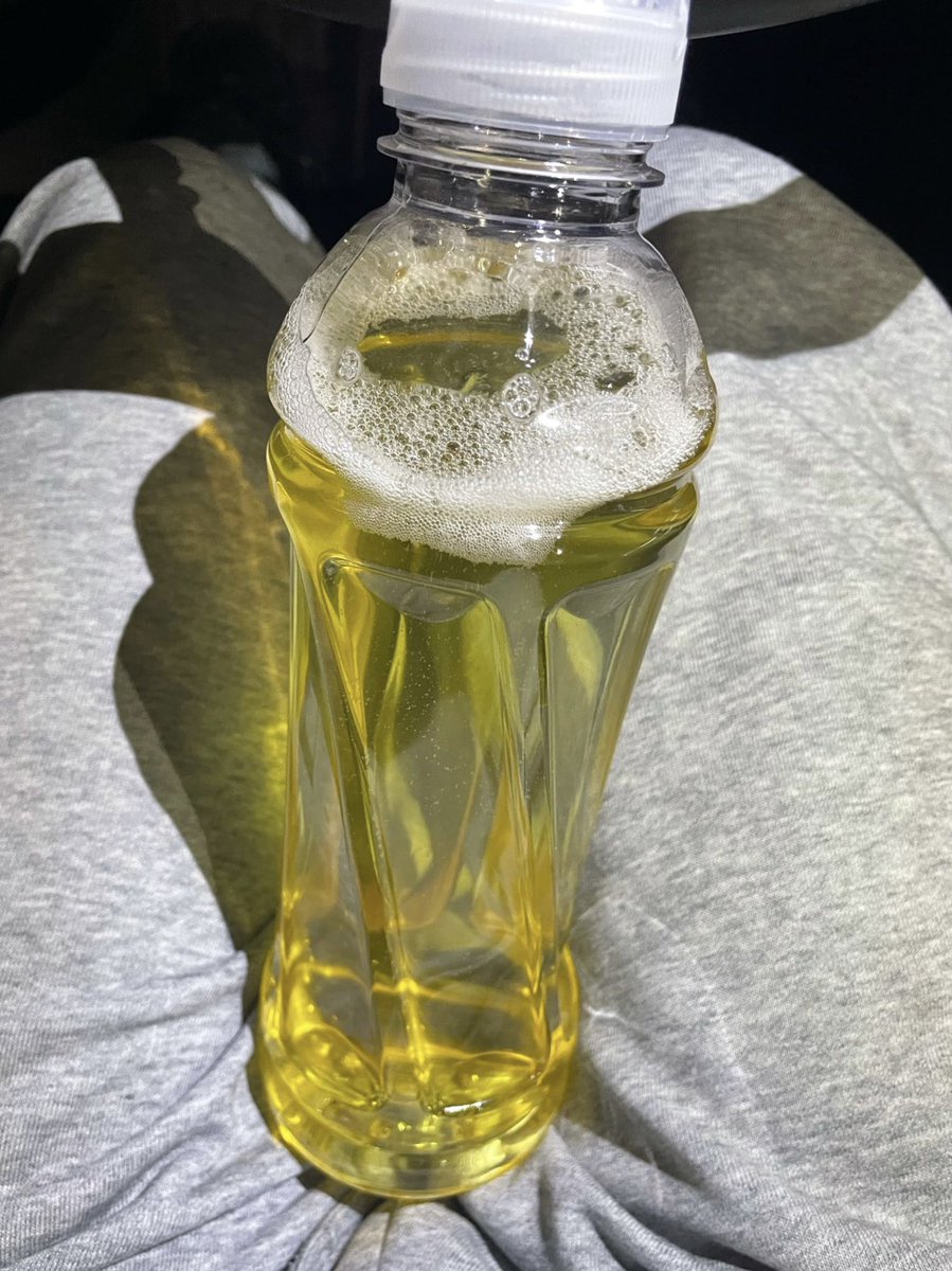aa81823653's tweet photo. 就没有淡一点的嘛 ��爱喝水？？？ https://t.co/RyyJBQEy8q
