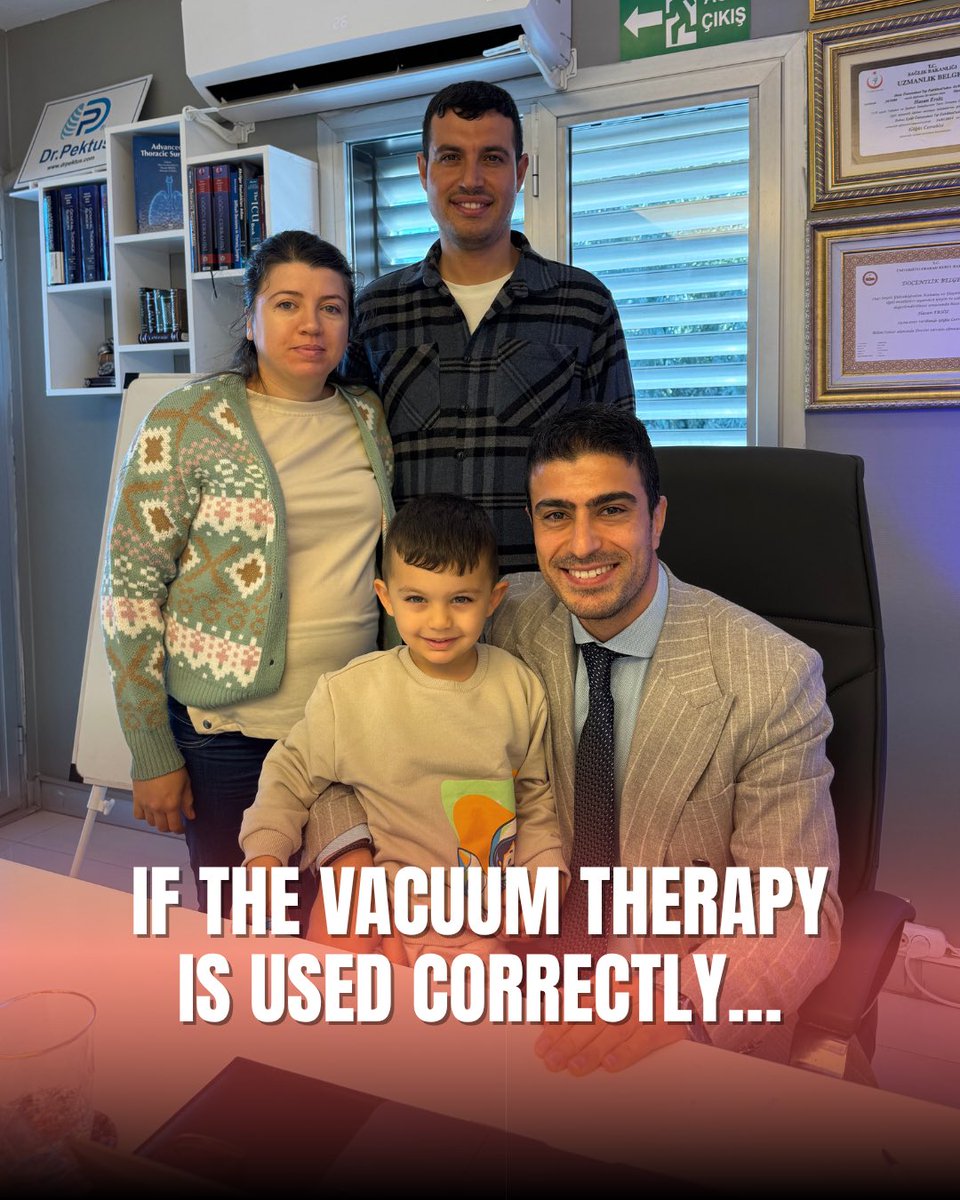 drpektus's tweet image. “Did you know? With the right vacuum therapy plan, pectus excavatum depth can significantly improve within just a few months.”

#pectusexcavatum #vacuumtherapy #chestwall #pediatricsurgery #drhasanersoz