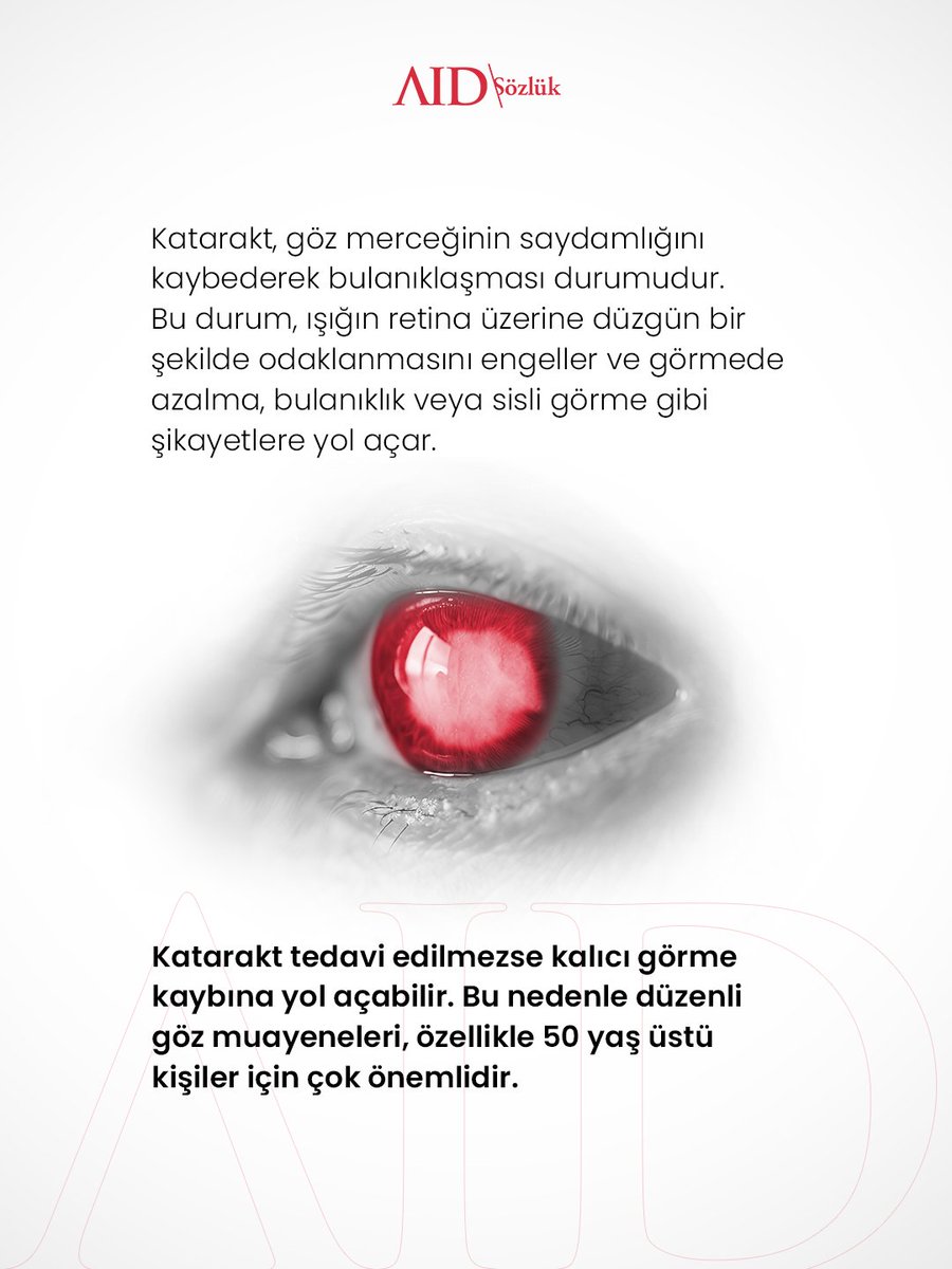 Katarakt, göz merceğinin saydamlığını yitirmesiyle ortaya çıkan bulanık bir dünya yaratır. Özellikle 50 yaş üstünde düzenli göz kontrolü, net bir yaşam için kritik önemdedir. Göz sağlığına dair farkındalığı birlikte güçlendiriyoruz.