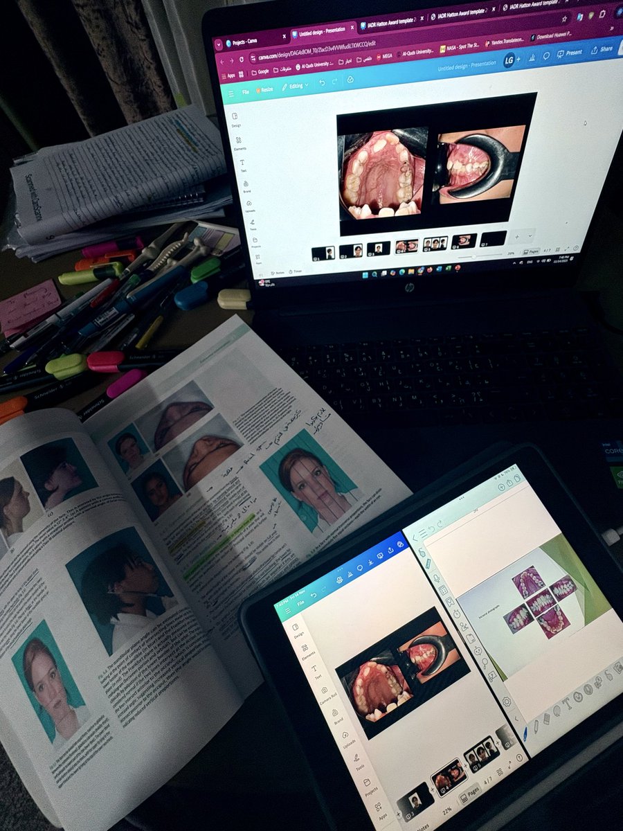 LaraIbrahim04's tweet image. Orthodontist Days 🫶🏻