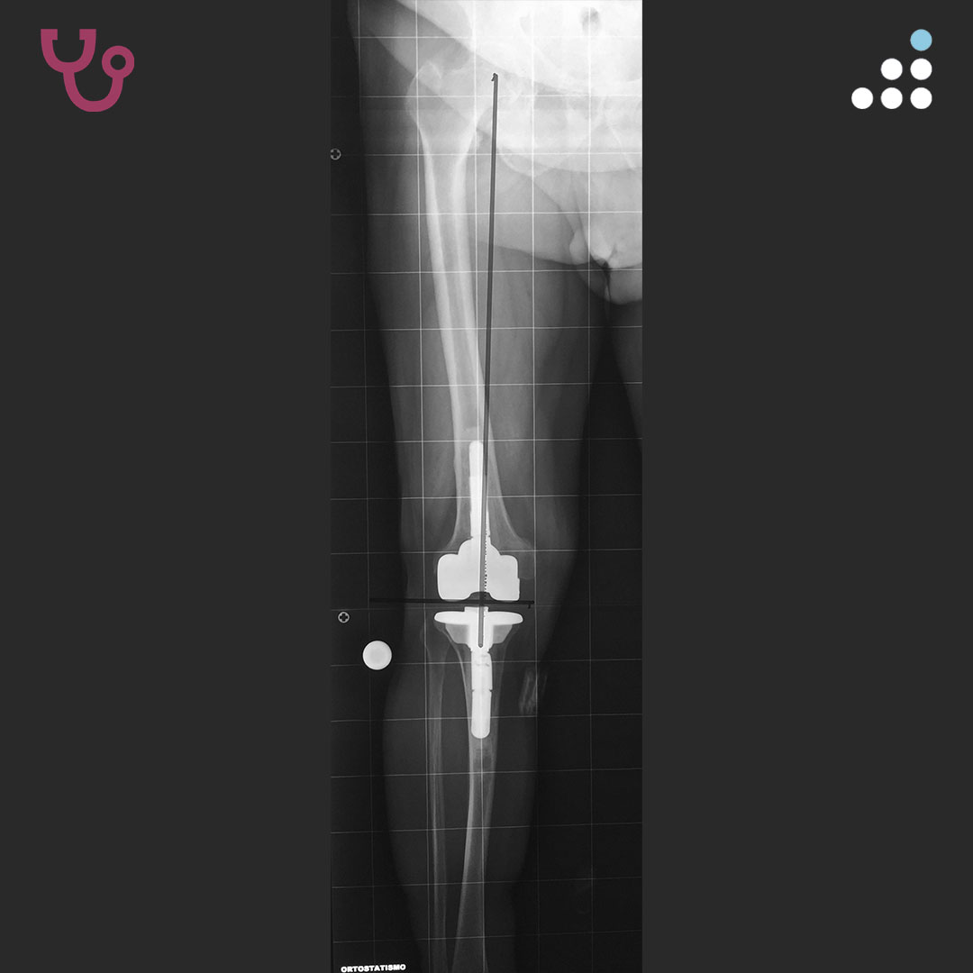 Orthobullets tweet media