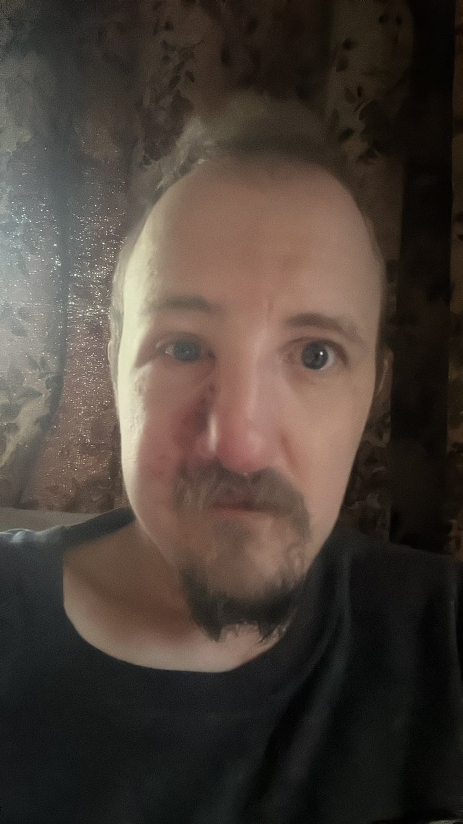 Sorry not been on here. I might have the shingles