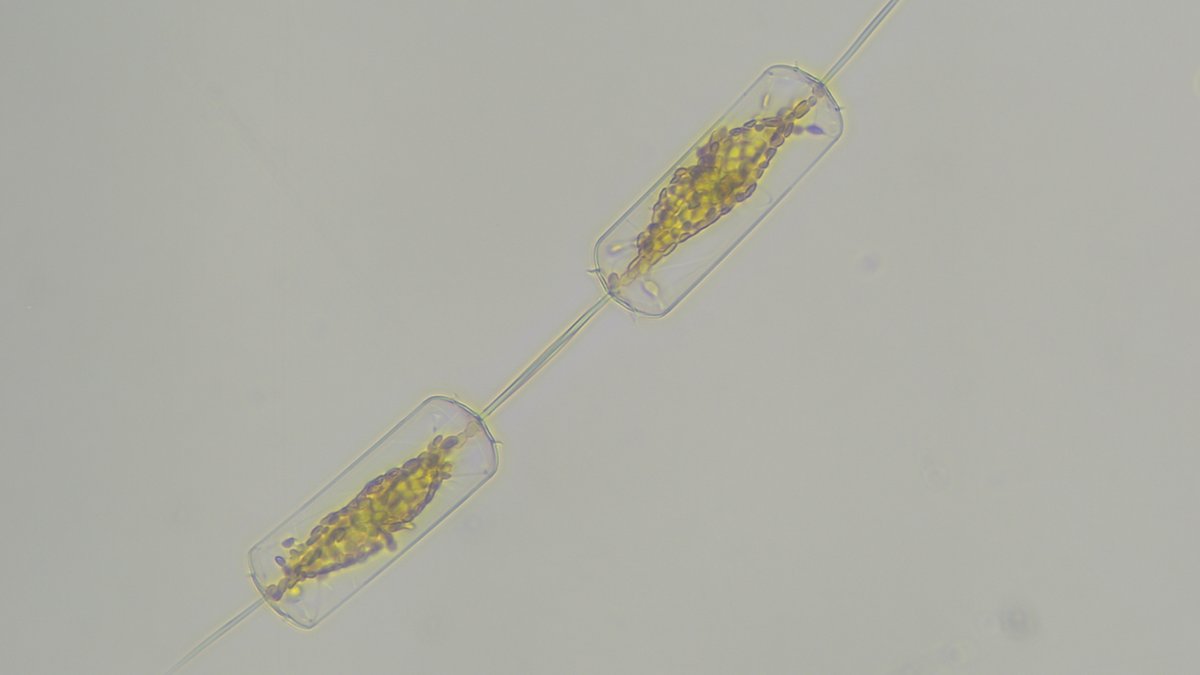 plancton_andino's tweet image. Esta activa nuestra nueva versión de #ADICFito la cual es una contribución de imágenes del plancton, usando custom vision y otras herramientas de la #informatica.   #POAS #PSMB #AQUA #FJORD #BloomPreditor #phytoplankton #ImageJ                         
@MowiCanadaWest @AQUASocial…