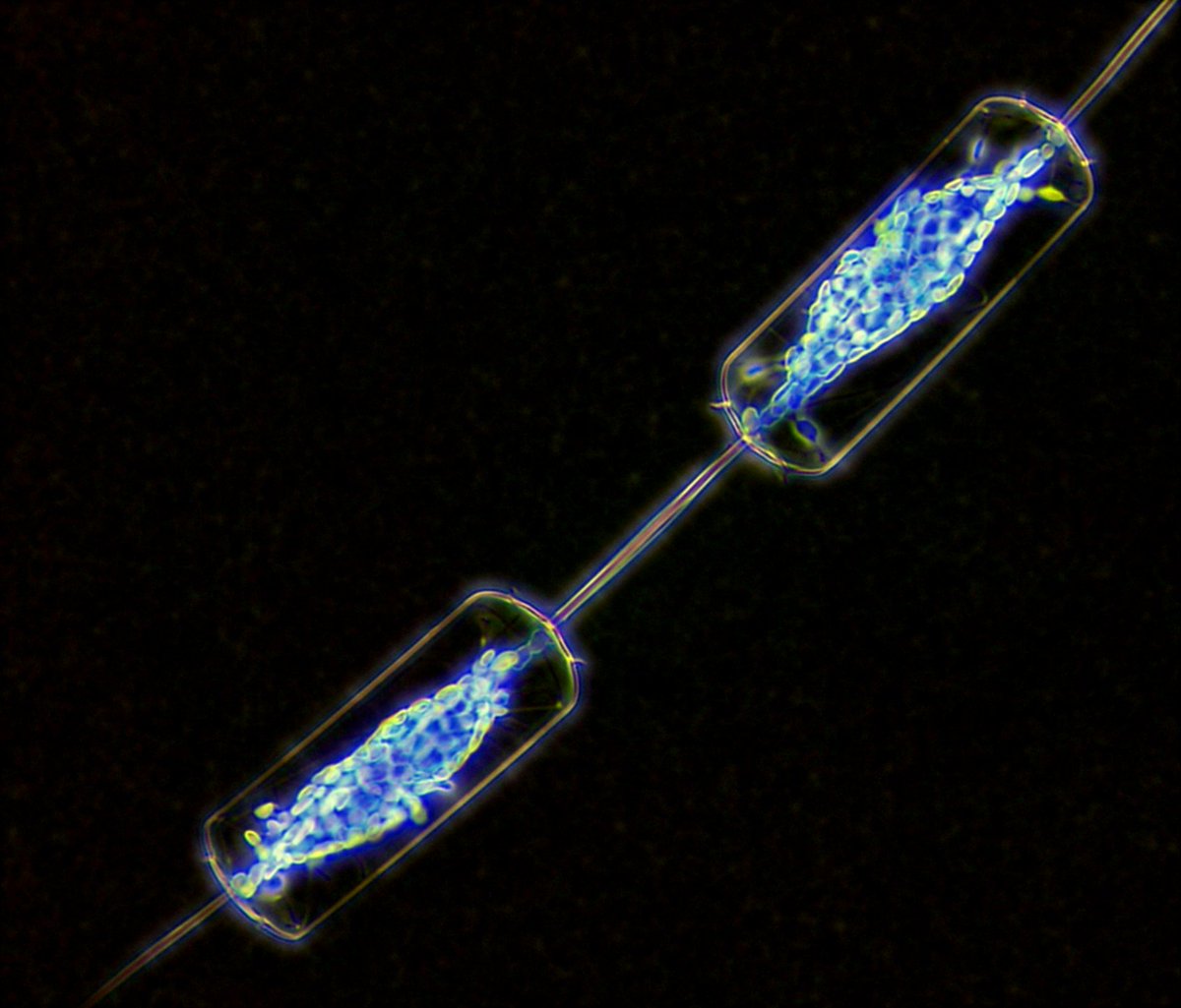 plancton_andino's tweet image. Esta activa nuestra nueva versión de #ADICFito la cual es una contribución de imágenes del plancton, usando custom vision y otras herramientas de la #informatica.   #POAS #PSMB #AQUA #FJORD #BloomPreditor #phytoplankton #ImageJ                         
@MowiCanadaWest @AQUASocial…