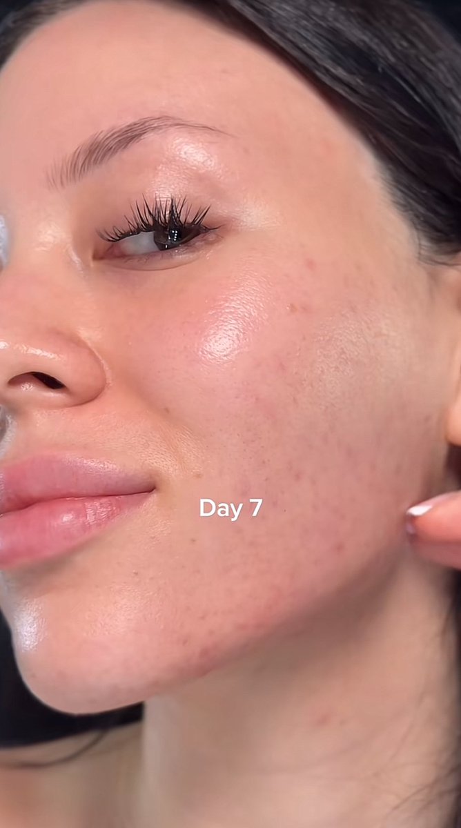 وش تتوقعو المنتج اللي غير بشرتها كذا باسبوع؟