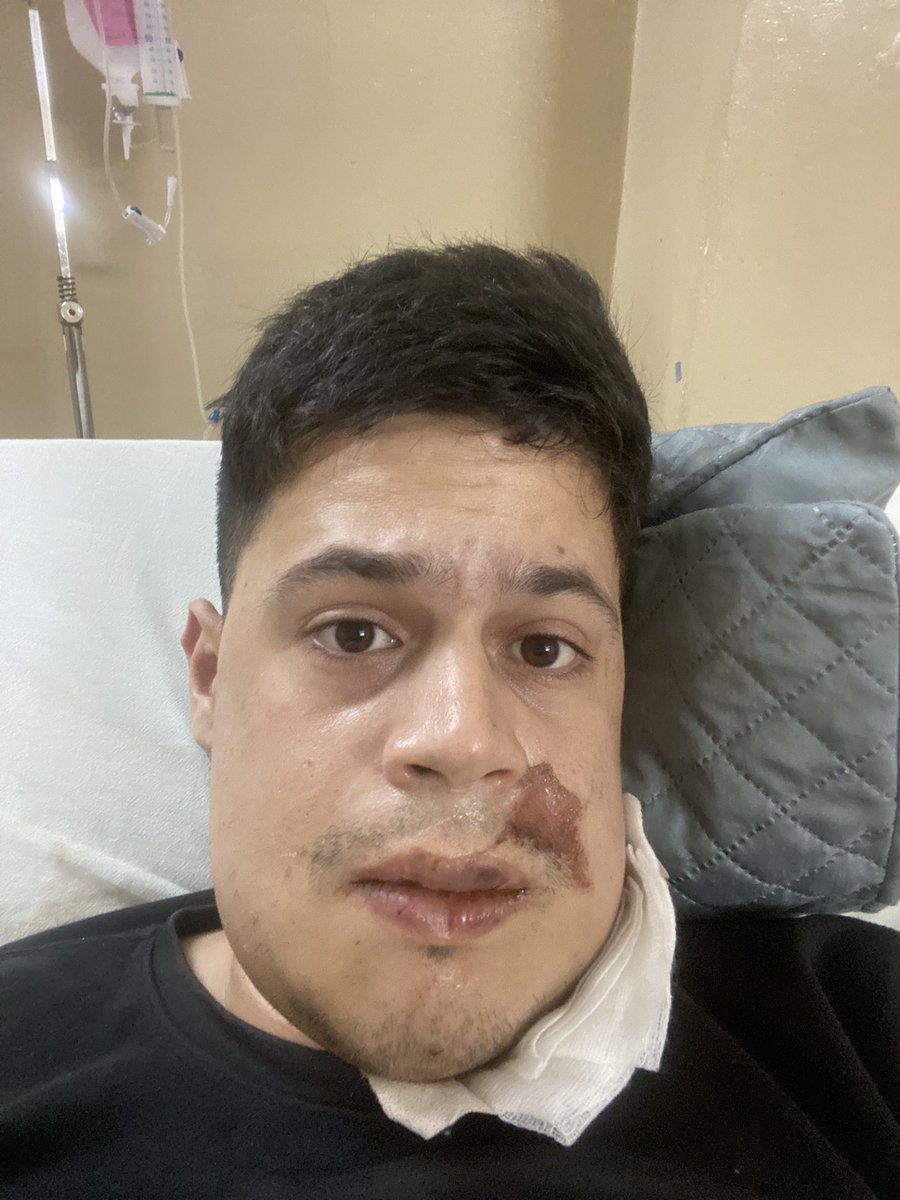 osvaldodaniel_'s tweet photo. GRACIAS a todos por sus mensajes!!! Como ya saben y es de público conocimiento, el martes tuve un accidente!!! Para la gente que quiera ayudar les dejo mi alias 09845914111 !!!

🙏💪🏻❤️ https://t.co/nUFDHvF9tx