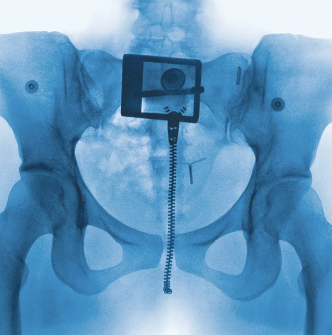 GingerReload's tweet image. Le nominations ai Grammy sono sempre teatro di grandi dibattiti, ma su questo tutti si trovano concordi: l’esclusione totale di “Virgin” di #LORDE è ASSURDA. Ecco la mia recensione, nella quale vi racconto cosa si cela dietro ai testi. 

🔵 LEGGILA QUI 👉 facebook.com/share/p/1AKhui…