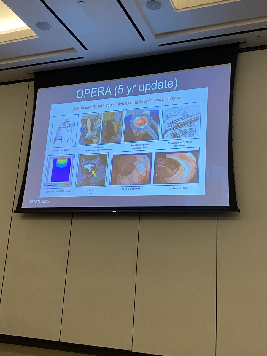 DrJohnSuh's tweet image. Outstanding talk by Dr. Erik Davies, PGY5 ⁦@CleClinicMD⁩ #radonc resident, on management of GI tumors during the 27th Annual Best of Radiation Oncology Update! Super proud that you will focus on GI tumors ⁦@DukeRadOnc⁩ next year! ⁦@ARRO_org⁩ #CleClinicCancer