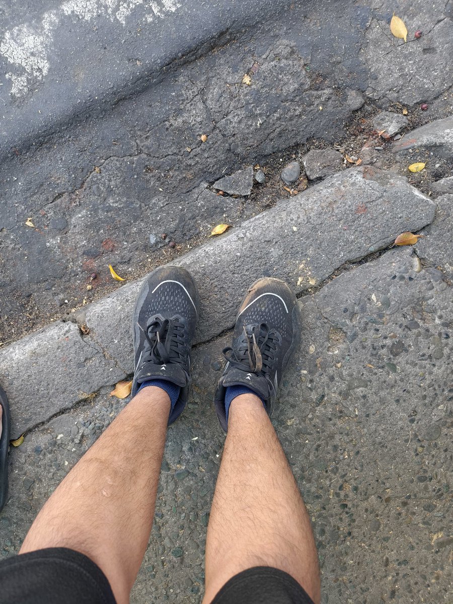 Dan02393's tweet photo. Atm town Baguio...yung after mamuno kntas punta sa Dentist dahil sa lintik na bracket kakakabit lang nong Friday natanggal nanaman kahapon hayst🤧
#igorot
#baguio#benguet https://t.co/gXxTiliFYs