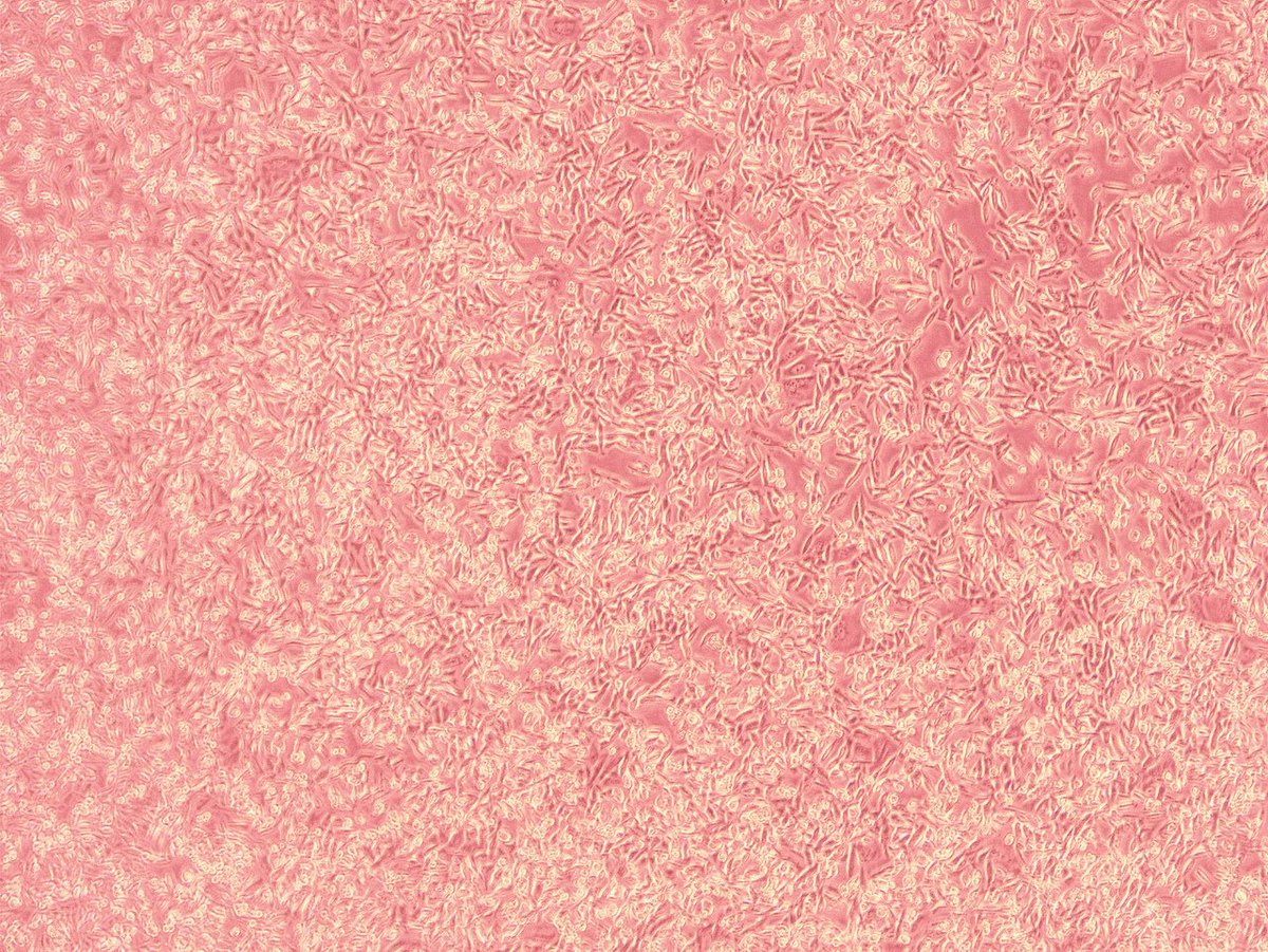 Presenting the first piece in my new artistic collection "images that are mesmerizing for an artist but horrifying for a biologist" ❤️👩‍🎨

Titled: "Way-overconfluent HEK cells (pt I)"