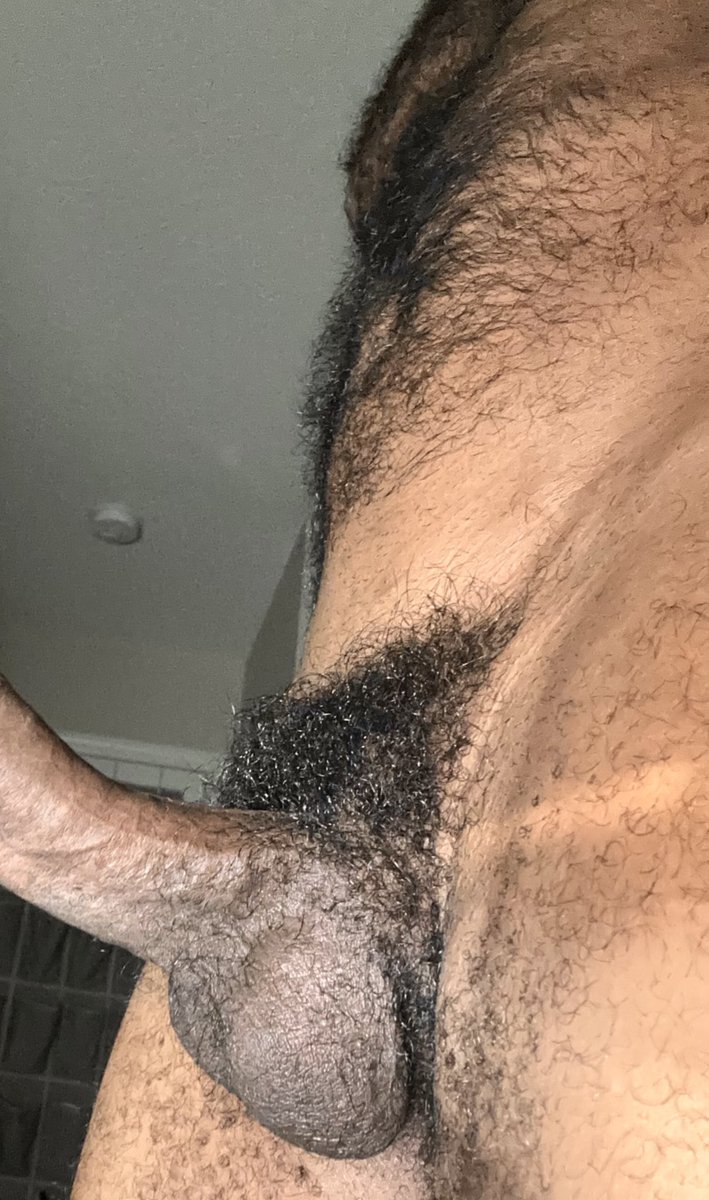 My gawd I’m hairy