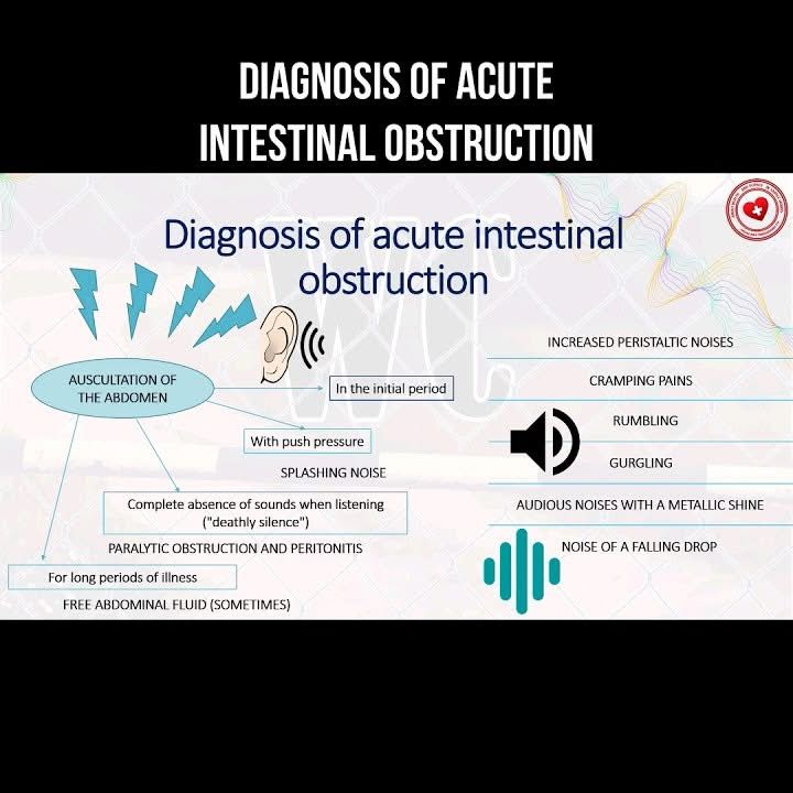 AllScientifical's tweet image. Diagnosis of acute intestinal obstruction #auscultation #obstruction #intestinal #diagnosis
 ... Continue to: youtube.com/shorts/CCcnyfR…