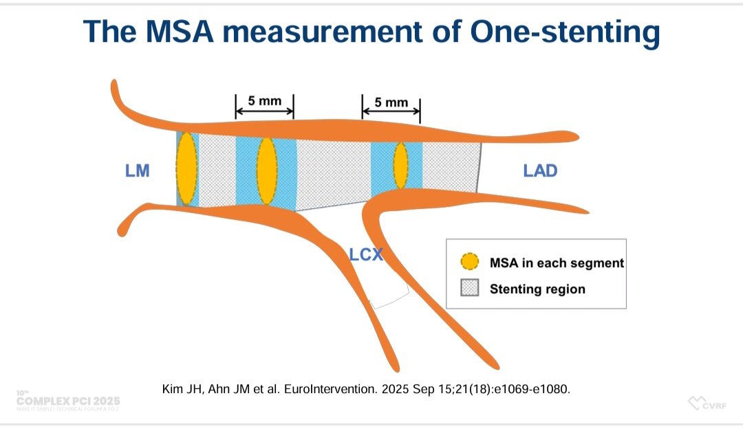 Zill_cardio's tweet photo. #COMPLEXPCI2025
What is the cut-off for Optimal MSA in LM Crossover Stenting ⁉️
Proximal LM MSA : 11.4mm2
Distal LM MSA : 8.4mm2
Proximal LAD MSA : 8.1mm2
#LMPCI #ProvisionalStenting #Imagefirst @summitmd_cvrf #1/2 https://t.co/vhhbbegTI9