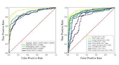 Radiology_AI's tweet image. A self-supervised text-vision framework that can accurately detect clinically relevant brain MRI  abnormalities without expert-labelled training data doi.org/10.1148/ryai.2… @KingsCollegeLon #brain #DeepLearning #AI