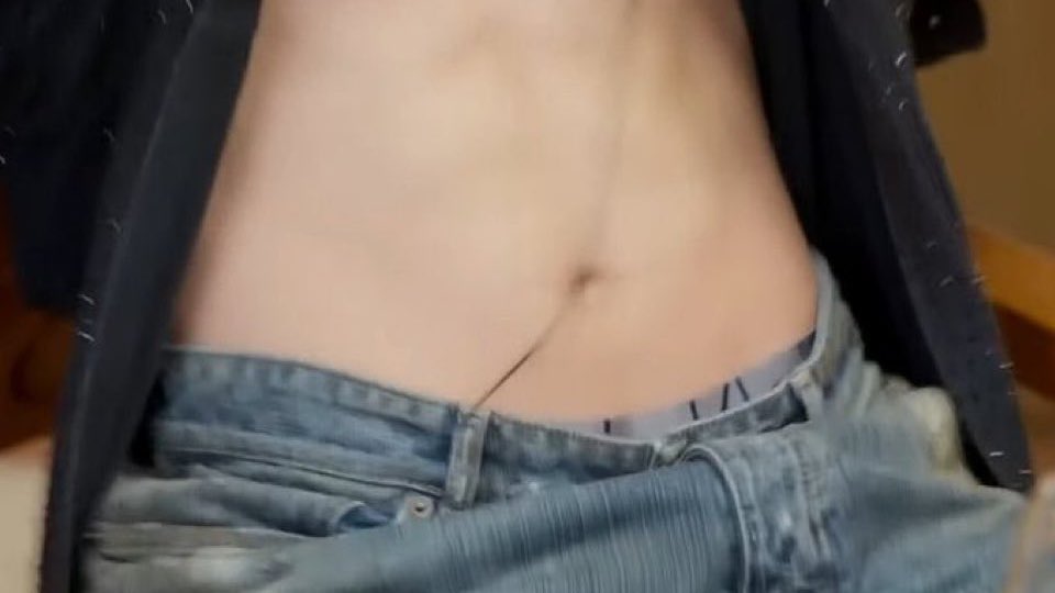 kooshubbyhere's tweet image. My boy is suffering from this problem 😫