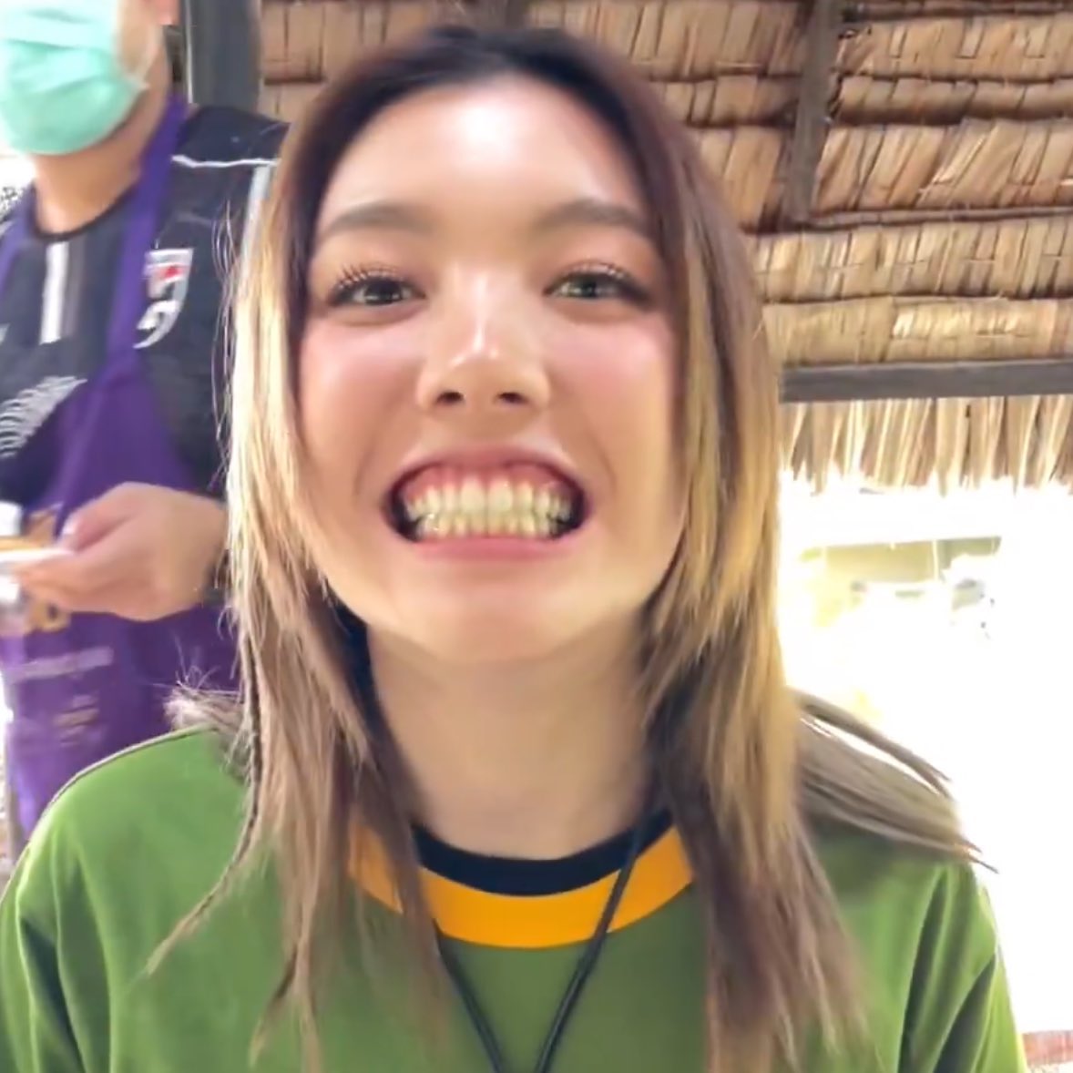 ขอดูฟันหน่อยกั้ป!