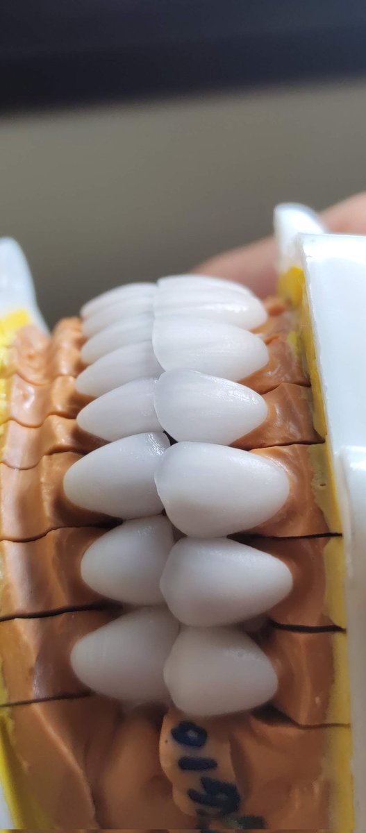 SunSmile_Lab's tweet image. RĂNG SỨ THẨM MỸ CHÍNH HÃNG CAO CẤP 🔥🔥🔥