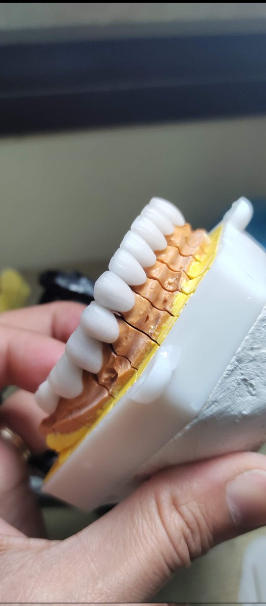 SunSmile_Lab's tweet image. RĂNG SỨ THẨM MỸ CHÍNH HÃNG CAO CẤP 🔥🔥🔥