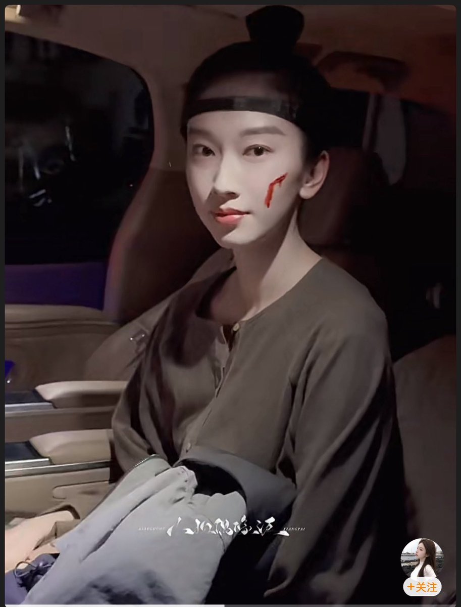 Moo_Mint's tweet image. ติงอูเต็มไปด้วยความกังวล ในขณะที่ลู่อิงซึ่งใบหน้าของเธอเต็มไปด้วยเลือด ปลอบใจทุกคนว่า &quot;ไม่เป็นไรนะ คไม่ตายหรอก มันเป็นแค่การบาดเจ็บเล็กน้อยเท่านั้น&quot;
แก้มซ้ายของลู่อิงถูกกระสุนลูกหลงเฉี่ยวจนเกิดบาดแผลตั้งแต่โหนกแก้มซ้ายไปจนถึงหู โดยมีผิวหนังและเนื้อเยื่อม้วนงอขึ้น
(ต่อข้างล่าง)