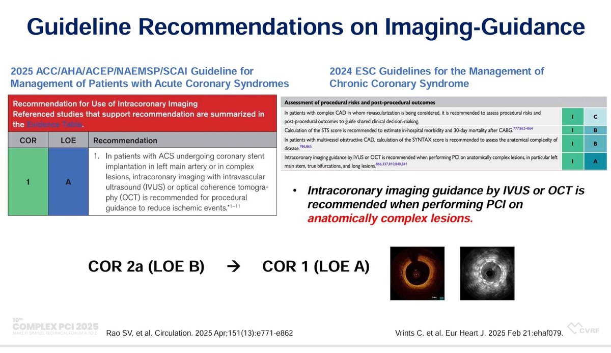 Zill_cardio's tweet photo. #COMPLEXPCI2025

💥Imaging-Guided Strategies for Managing Calcified Coronary Lesions

Why We Need Imaging Modalities for the Treatment of Calcified Coronary Lesions ⁉️

Available Evidence and Guideline Recommendations 👇

#CalcifiedPCI #IVImaging @summitmd_cvrf #1/3 https://t.co/pUa9qkIYbF