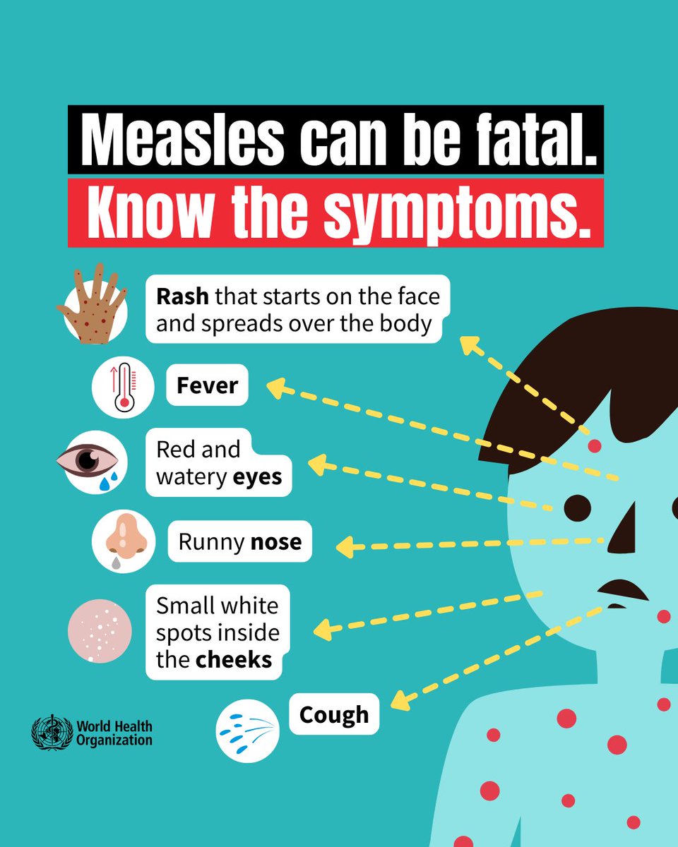 WHO's tweet photo. #Measles can be fatal.

Do you know its symptoms?

🔴 Rash that starts on the face and spreads over the body
🔴 Fever
🔴 Cough
🔴 Red and watery eyes
🔴 Small white spots inside the cheeks

Seek health care if you suspect you or your child has measles https://t.co/XG6xSanERK https://t.co/IH9Om88wos