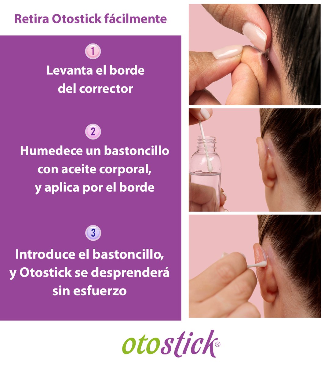 Sigue estos sencillos pasos para retirar Otostick fácilmente:.👂😉

otostick.com
💜💜💜💜