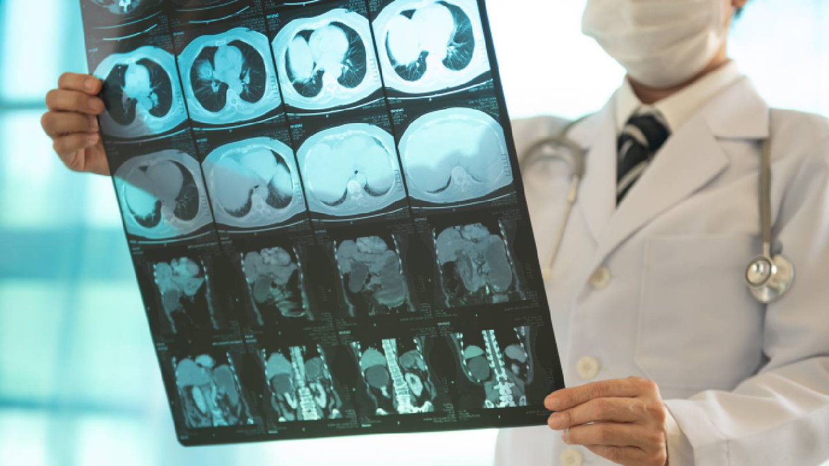 a2z Radiology AI receives FDA clearance for abdomen-pelvis CT device

The a2z-Unified-Triage device is designed to simultaneously flag and prioritise seven urgent findings on abdomen-pelvis CT scans. 

 medicaldevice-network.com/news/a2z-radio…