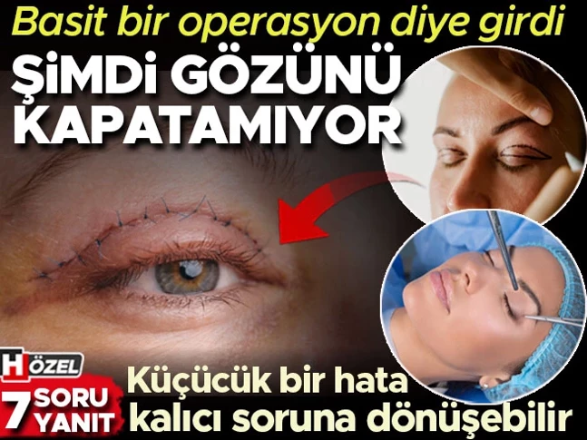 Hurriyet's tweet photo. Basit bir operasyon diye girdi, şimdi bir gözünü tam kapatamıyor

7 SORUDA GÖZ KAPAĞI ESTETİĞİ

🖊️@batisedef haberi...

https://t.co/3moMXGISAK https://t.co/VSzxAB39jr